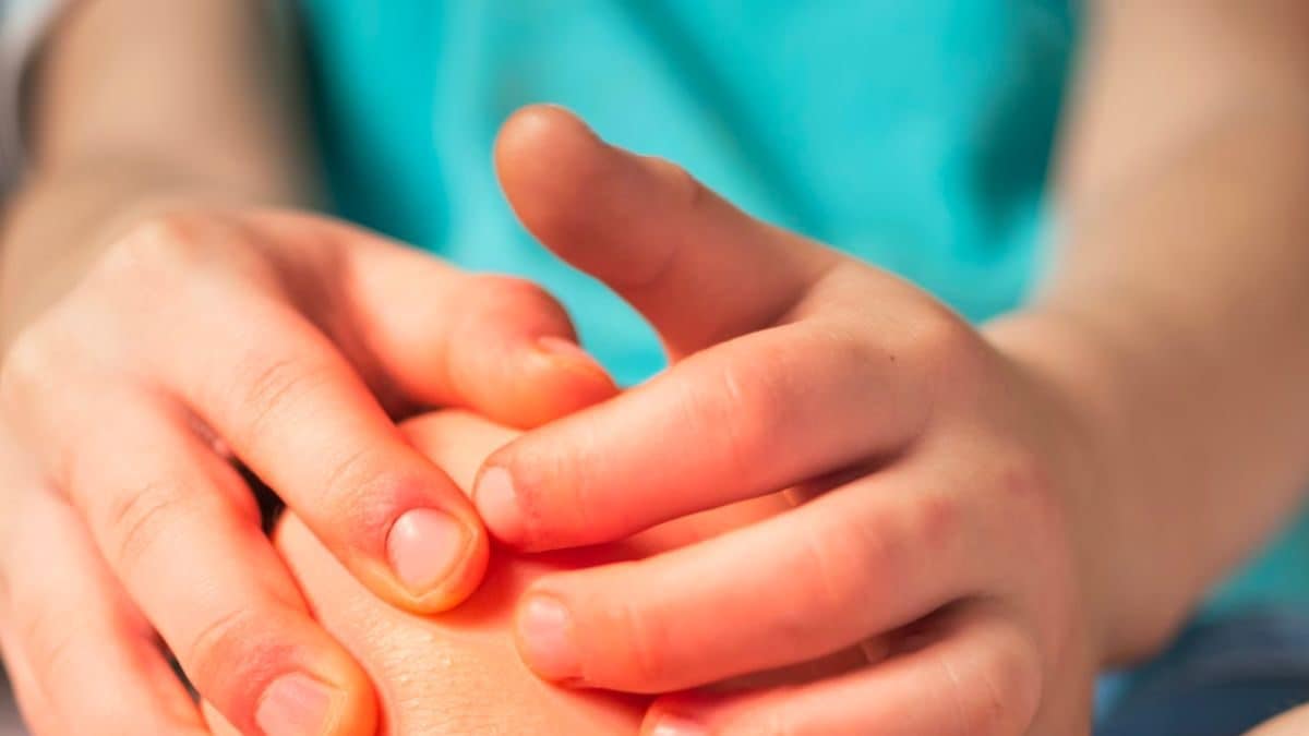 Understanding The Onset of Arthritis In Children – News18
